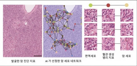 서울대 권성훈 교수 공동연구팀, AI 기술로 ‘암세포 네트워크’ 규명 통한 차세대 암 진단 지표 개발